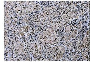 IHC analysis of Fos B/FOSB using anti-Fos B/FOSB antibody (ABIN7599279). (FOSB Antikörper  (AA 1-332))