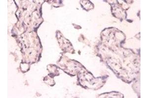 Immunohistochemistry of paraffin-embedded human placenta tissue using ABIN7159368 at dilution of 1:100 (PKMYT1 Antikörper  (AA 900-1101))