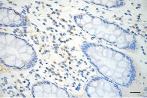 anti-Penta-EF-Hand Domain Containing 1 (PEF1) antibody