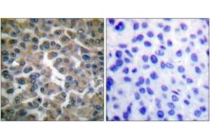 Immunohistochemistry (IHC) image for anti-Nuclear Factor of kappa Light Polypeptide Gene Enhancer in B-Cells Inhibitor, epsilon (NFKBIE) (AA 131-180) antibody (ABIN2888569) (NFKBIE Antikörper  (AA 131-180))