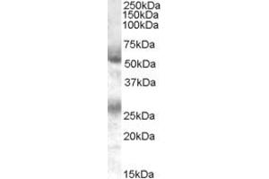 Western Blotting (WB) image for anti-Feline Leukemia Virus Subgroup C Cellular Receptor 1 (FLVCR1) (C-Term) antibody (ABIN2465703) (FLVCR Antikörper  (C-Term))