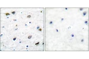 Immunohistochemistry analysis of paraffin-embedded human brain tissue, using GABA-RB (Ab-434) Antibody. (GABA-RB (AA 401-450) Antikörper)