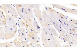 Detection of MAPK6 in Human Cardiac Muscle Tissue using Polyclonal Antibody to Mitogen Activated Protein Kinase 6 (MAPK6) (MAPK6 Antikörper  (AA 1-316))
