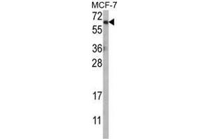 Western blot analysis of AKT1 Antibody (N-term) in MCF-7 cell line lysates (35ug/lane). (AKT1 Antikörper  (N-Term))