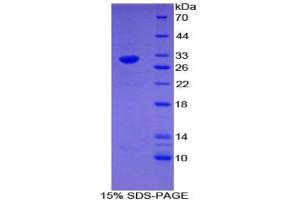 SDS-PAGE analysis of Mouse EGR4 Protein. (EGR4 Protein)
