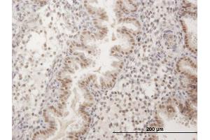 Immunoperoxidase of purified MaxPab antibody to FKBP5 on formalin-fixed paraffin-embedded human endometrium.