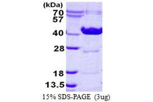 Image no. 1 for Ornithine Carbamoyltransferase (OTC) (AA 33-354) protein (His tag) (ABIN7279762)