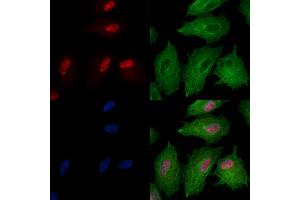 Phospho-SIRT6 (Ser10) Antibody staining A549 cells(heat shock treatment) by IF/ICC. (SIRT6 Antikörper  (pSer10))