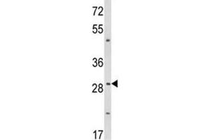 Western blot analysis of TTP antibody and WiDr lysate (ZFP36 Antikörper  (AA 116-142))