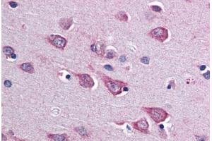 Human Brain, Cortex (formalin-fixed, paraffin-embedded) stained with SOCS1 antibody ABIN343903 at 5 ug/ml followed by biotinylated goat anti-rabbit IgG secondary antibody ABIN481713, alkaline phosphatase-streptavidin and chromogen. (SOCS1 Antikörper  (C-Term))