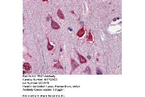 Immunohistochemistry with Human Brain, cortex tissue at an antibody concentration of 5.