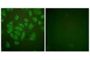 Immunofluorescence analysis of A549 cells, using Stefin A antibody. (CSTA Antikörper  (C-Term))