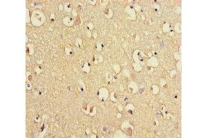 Immunohistochemistry of paraffin-embedded human brain tissue using ABIN7151262 at dilution of 1:100