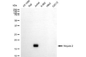 anti-Ninjurin 2 (NINJ2) antibody