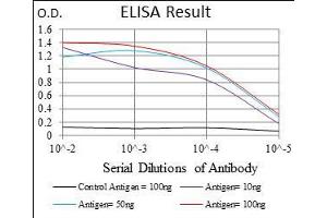 Black line: Control Antigen (100 ng), Purple line: Antigen(10 ng), Blue line: Antigen (50 ng), Red line: Antigen (100 ng), (Calmegin Antikörper  (AA 249-405))