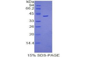 SDS-PAGE (SDS) image for Osteocalcin (BGLAP) (AA 14-95) protein (His tag,GST tag) (ABIN1877236)