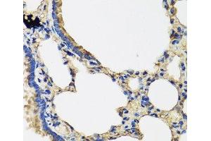 Immunohistochemistry of paraffin-embedded Rat lung using IL36G Polyclonal Antibody at dilution of 1:100 (40x lens). (IL1F9 Antikörper)