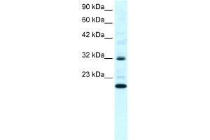 WB Suggested Anti-ARHGDIG Antibody Titration:  0. (ARHGDIG Antikörper  (N-Term))