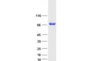 Western Blotting (WB) image for Methylenetetrahydrofolate Reductase (NAD(P)H) (MTHFR) protein (Myc-DYKDDDDK Tag) (ABIN2726510)