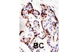Immunohistochemistry (Paraffin-embedded Sections) (IHC (p)) image for anti-Suppressor of Variegation 3-9 Homolog 2 (Drosophila) (SUV39H2) (AA 93-122), (N-Term) antibody (ABIN388081)