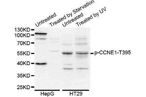 Western Blotting (WB) image for anti-Cyclin E1 (CCNE1) (pThr395) antibody (ABIN3019435) (Cyclin E1 Antikörper  (pThr395))