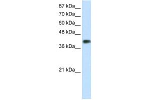 WB Suggested Anti-DLX3 Antibody Titration:  1. (DLX3 Antikörper  (C-Term))
