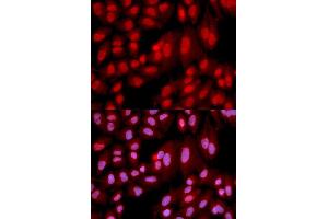 Immunofluorescence analysis of U2OS cell using PPP2R2A antibody. (PPP2R2A Antikörper)