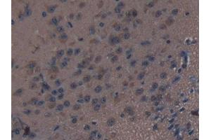 DAB staining on IHC-P; Samples: Mouse Brain Tissue (Thrombospondin 1 Antikörper  (AA 61-259))
