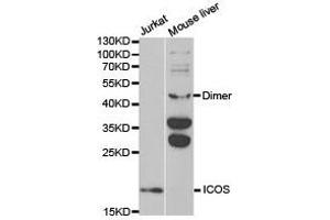 Western Blotting (WB) image for anti-Inducible T-Cell Co-Stimulator (ICOS) antibody (ABIN1873127) (ICOS Antikörper)