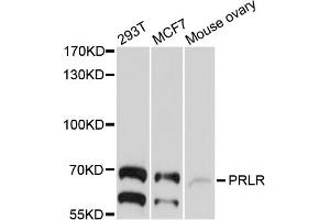 Western blot analysis of extracts of various cell lines, using PRLR antibody (ABIN4904864) at 1:1000 dilution. (Prolactin Receptor Antikörper)