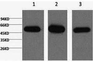 Western Blotting (WB) image for anti-Tubulin, beta 1 (TUBB1) antibody (ABIN5956137) (TUBB1 Antikörper)