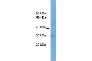 Human 293T; WB Suggested Anti-TAPBP Antibody Titration: 0.