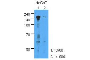 The extracts of HaCaT (35 ug) were resolved by SDS-PAGE, transferred to PVDF membrane and probed with anti-human EGFR (1:500 or 1000). (EGFR Antikörper  (AA 424-605))
