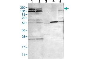 Western blot analysis of Lane 1: RT-4, Lane 2: U-251 MG, Lane 3: Human Plasma, Lane 4: Liver, Lane 5: Tonsil with PARP14 polyclonal antibody  at 1:250-1:500 dilution. (PARP14 Antikörper)