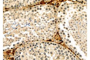 ABIN6262237 and ABIN6278474 at 1/100 staining Mouse lung tissue by IHC-P. (HIF3A Antikörper  (Internal Region))