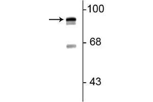Western blot of rat lung lysate showing specific immunolabeling of the ~93 kDa periostin protein doublet. (Periostin Antikörper  (C-Term))