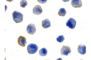 Immunohistochemistry (IHC) image for anti-CASP8 and FADD-Like Apoptosis Regulator (CFLAR) (N-Term) antibody (ABIN1031381) (FLIP Antikörper  (N-Term))