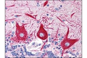 Image no. 1 for anti-Solute Carrier Family 15 (Oligopeptide Transporter), Member 1 (SLC15A1) (C-Term) antibody (ABIN372305)