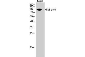 Western Blotting (WB) image for anti-Nuclear Factor of kappa Light Polypeptide Gene Enhancer in B-Cells 2 (NFKB2) (Thr160) antibody (ABIN3180753) (NFKB2 Antikörper  (Thr160))