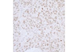 anti-Thymopoietin (TMPO) (AA 200-250) antibody