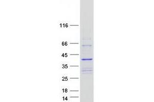 Validation with Western Blot (COLEC11 Protein (Transcript Variant 2) (Myc-DYKDDDDK Tag))