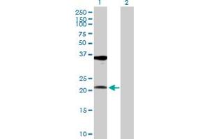 Western Blot analysis of RPL10A expression in transfected 293T cell line by RPL10A MaxPab polyclonal antibody. (RPL10A Antikörper  (AA 1-217))