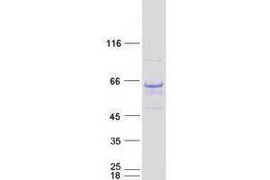 Western Blotting (WB) image for G Protein-Coupled Receptor Kinase Interactor 2 (GIT2) (Transcript Variant 4) protein (Myc-DYKDDDDK Tag) (ABIN2721505)