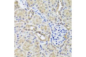 Immunohistochemistry of paraffin-embedded mouse kidney using CGB7 antibody (ABIN5974696) at dilution of 1/100 (40x lens). (CGB7 Antikörper)