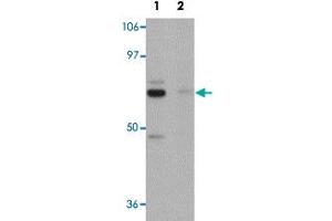 Western blot analysis of rat brain tissue with PIAS4 polyclonal antibody  at 1 ug/mL in (Lane 1) the absence and (Lane 2) the presence of blocking peptide . (PIAS4 Antikörper  (N-Term))