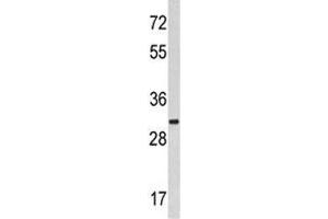 Western blot analysis of MARCKS antibody and HeLa lysate. (MARCKS Antikörper  (AA 241-271))