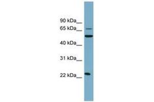 Image no. 1 for anti-C-Type Lectin Domain Family 6, Member A (CLEC6A) (AA 35-84) antibody (ABIN6743312) (C-Type Lectin Domain Family 6, Member A (CLEC6A) (AA 35-84) Antikörper)