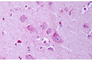 Anti-GABRB1 antibody IHC staining of human brain, cortex neurons. (GABRA1 Antikörper  (AA 327-450))