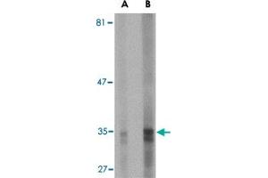Western blot analysis of ENDOG expression in HepG2 cell lysate with ENDOG monoclonal antibody, clone 7G1G10  at (A) 5 and (B) 10 ug/mL .
