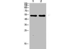 Western blot analysis of SW480 lysate, antibody was diluted at 1000. (ASIC1 Antikörper  (AA 220-280))